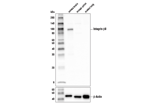 Western Blotting Image 1: Integrin β8 (D1V7M) Rabbit mAb