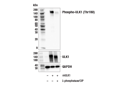 Western Blotting Image 1: Phospho-ULK1 (Thr180) Antibody