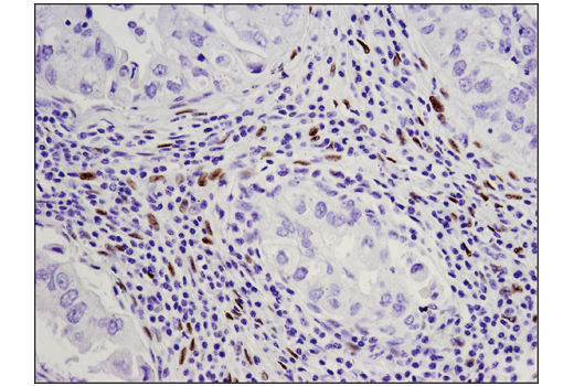 Immunohistochemistry Image 1: WT1 (D8I7F) XP® Rabbit mAb (BSA and Azide Free)