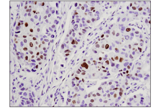 Immunohistochemistry Image 3: WT1 (D8I7F) XP® Rabbit mAb (BSA and Azide Free)