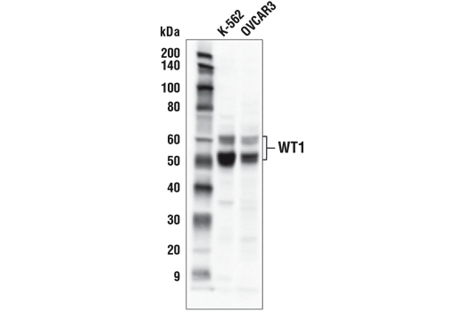 Western Blotting Image 1: WT1 (D8I7F) XP® Rabbit mAb (BSA and Azide Free)