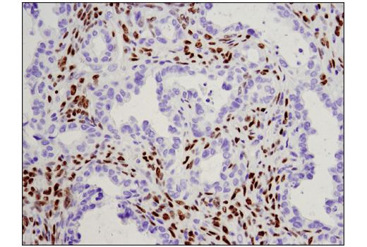 Immunohistochemistry Image 4: WT1 (D8I7F) XP® Rabbit mAb (BSA and Azide Free)