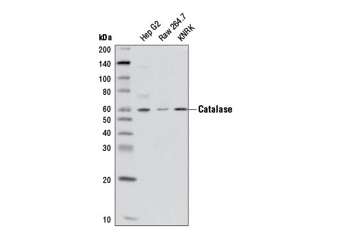 Western Blotting Image 1: Catalase Antibody