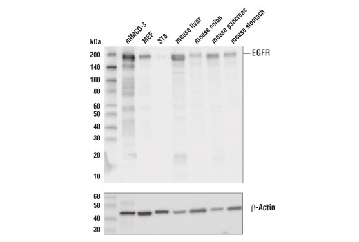 Western Blotting Image 1: EGF Receptor (D1P9C) Rabbit mAb (BSA and Azide Free)