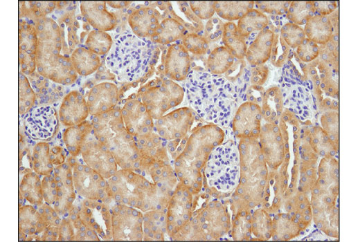 Immunohistochemistry Image 2: EGF Receptor (D1P9C) Rabbit mAb (BSA and Azide Free)