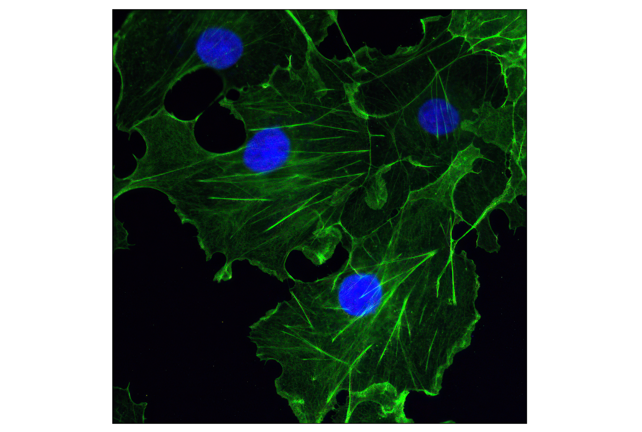 Immunofluorescence Image 1: β-Actin (13E5) Rabbit mAb (Alexa Fluor® 488 Conjugate)