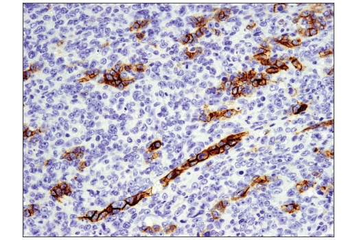 Immunohistochemistry Image 1: EpCAM (E6V8Y) XP® Rabbit mAb (Mouse Preferred) (BSA and Azide Free)