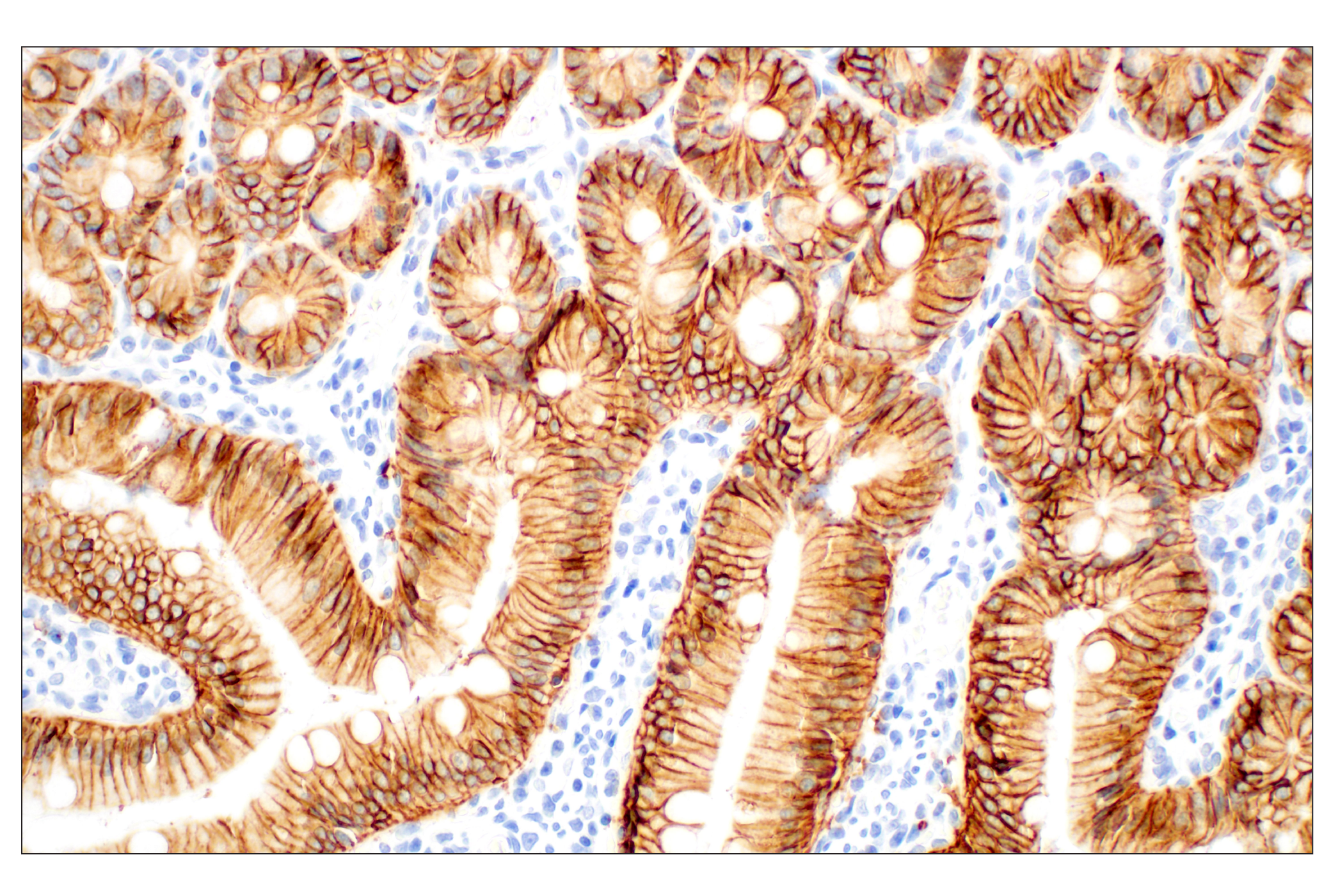 Immunohistochemistry Image 6: EpCAM (E6V8Y) XP® Rabbit mAb (BSA and Azide Free)
