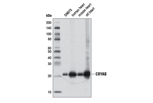 Western Blotting Image 1: CRYAB Antibody