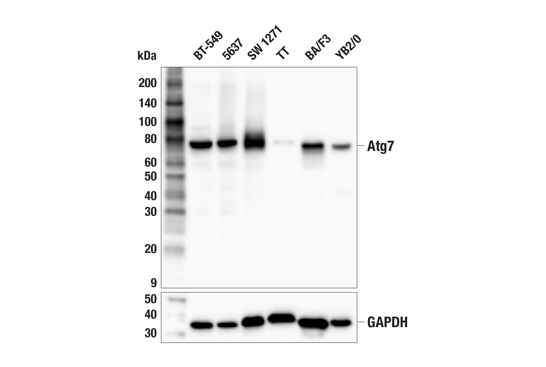Western Blotting Image 2: Atg7 (F4V2N) Rabbit mAb