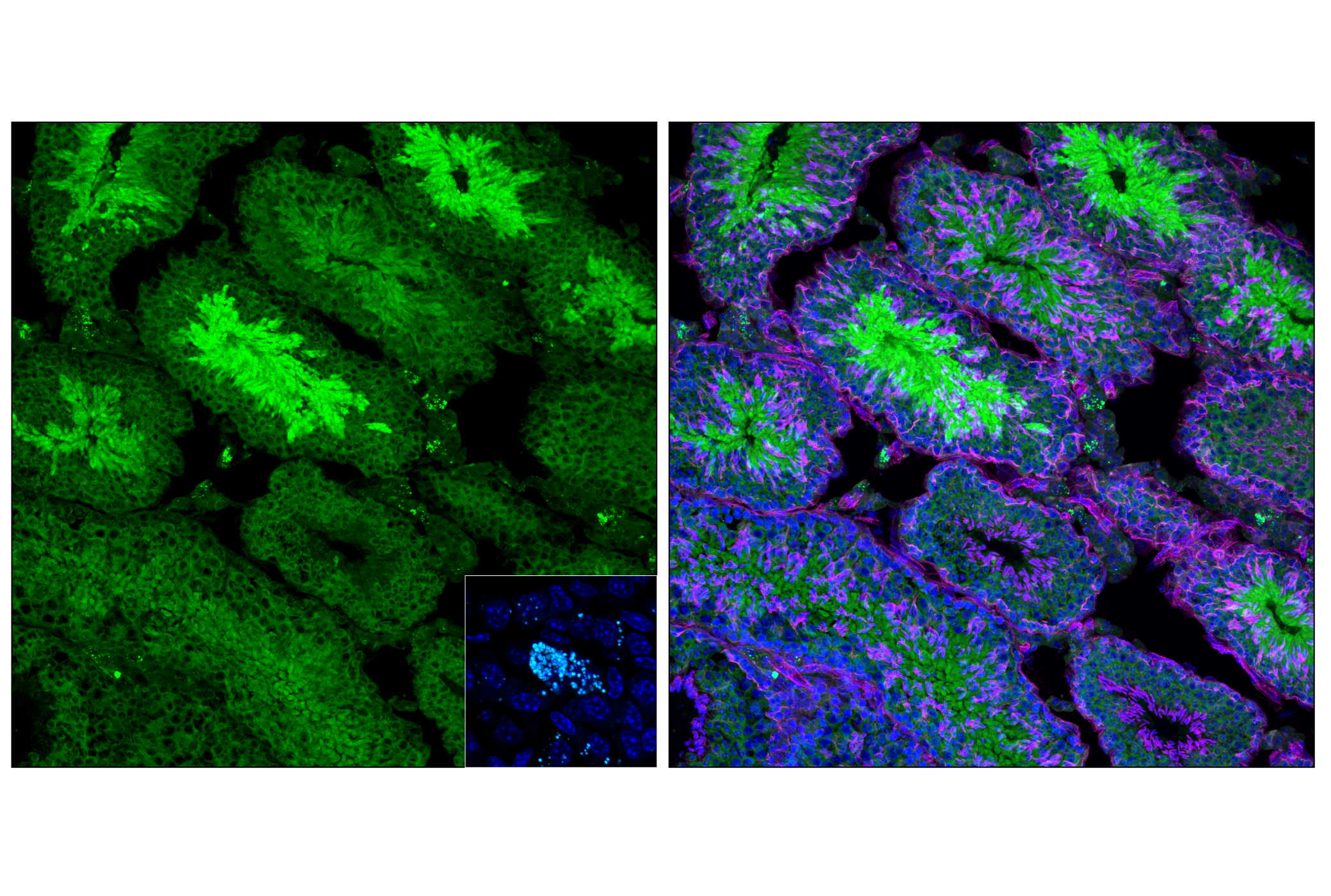Immunofluorescence Image 1: Atg7 (F4V2N) Rabbit mAb