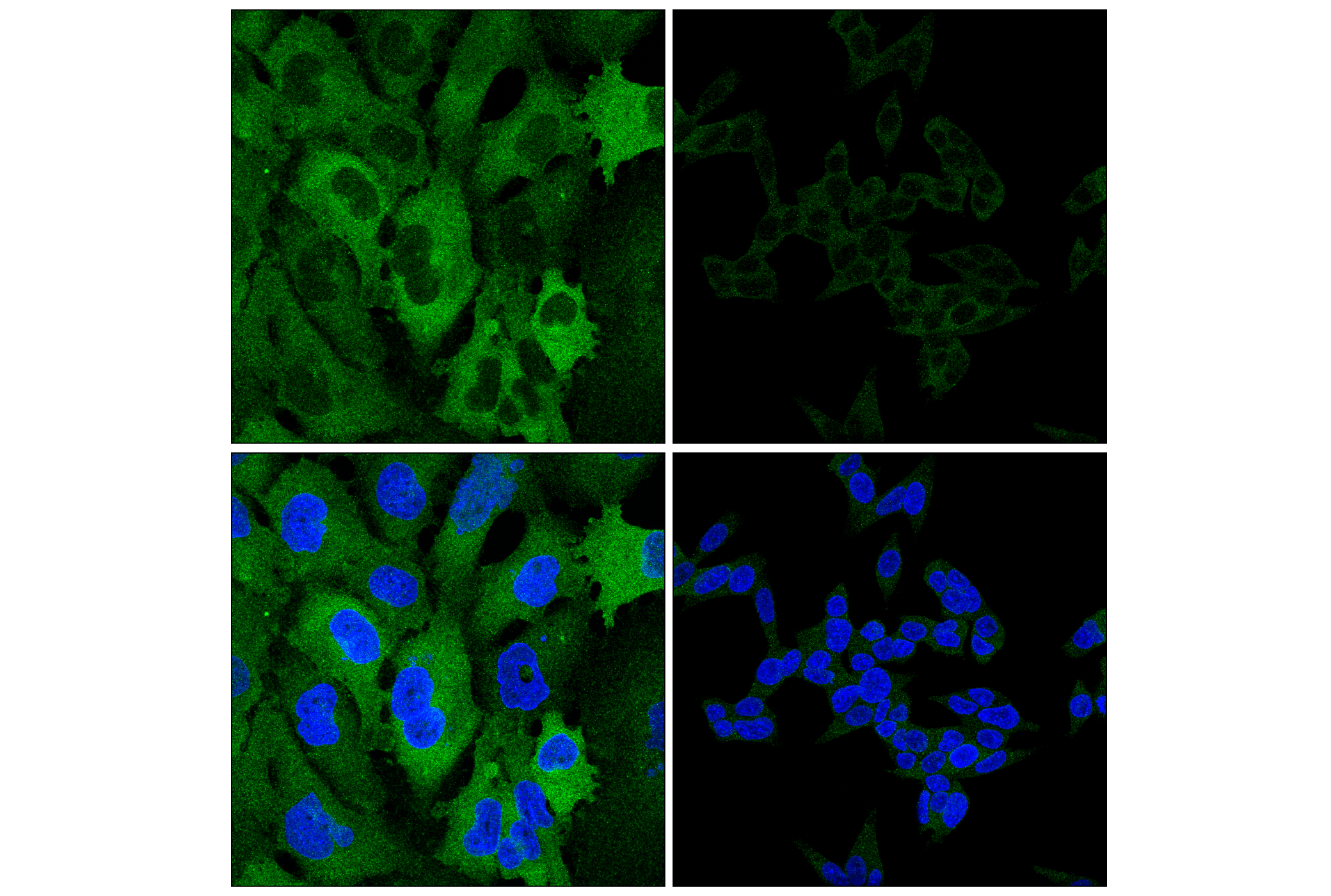 Immunofluorescence Image 2: Atg7 (F4V2N) Rabbit mAb