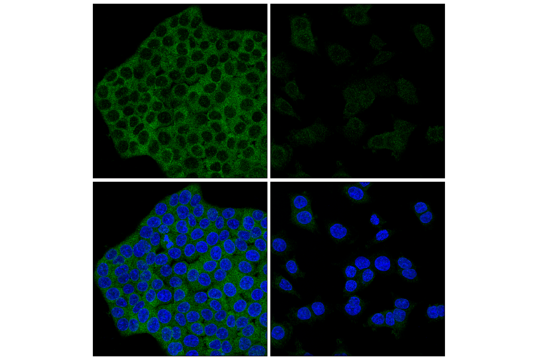 Immunofluorescence Image 3: Atg7 (F4V2N) Rabbit mAb