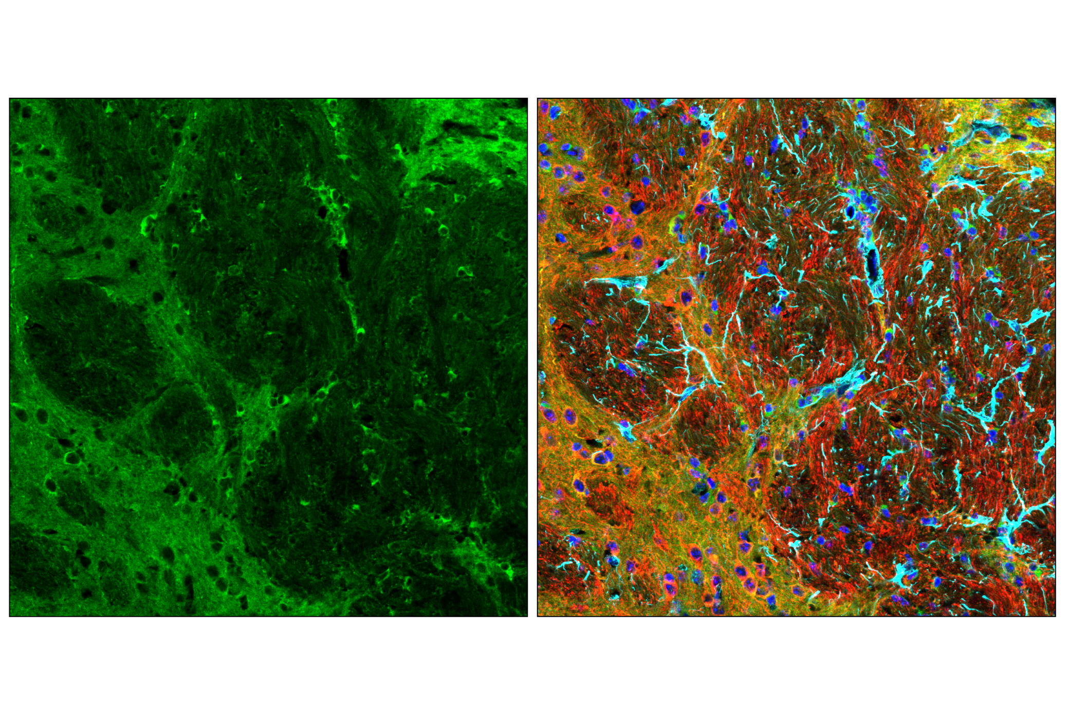Immunofluorescence Image 1: Phospho-Tau (Thr205) (E8Q5Z) Mouse mAb (BSA and Azide Free)