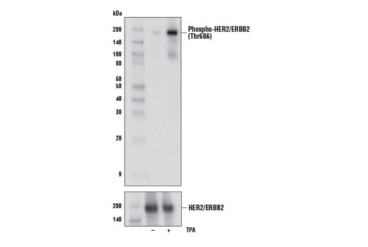 Western Blotting Image 1: Phospho-HER2/ErbB2 (Thr686) Antibody
