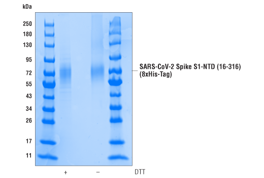  Image 1: SARS-CoV-2 Spike S1-NTD (16-316) Recombinant Protein (8xHis-Tag)