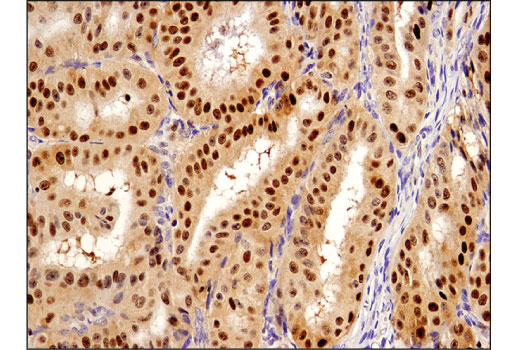 Immunohistochemistry Image 3: SQSTM1/p62 (D5L7G) Mouse mAb