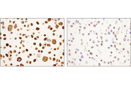 Immunohistochemistry Image 4: SQSTM1/p62 (D5L7G) Mouse mAb