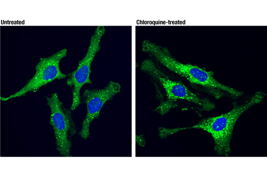 Immunofluorescence Image 1: SQSTM1/p62 (D5L7G) Mouse mAb