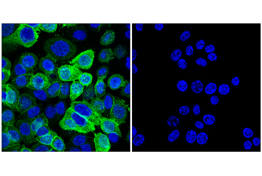 Immunofluorescence Image 1: Cadherin-17 (E5B1Y) Rabbit mAb