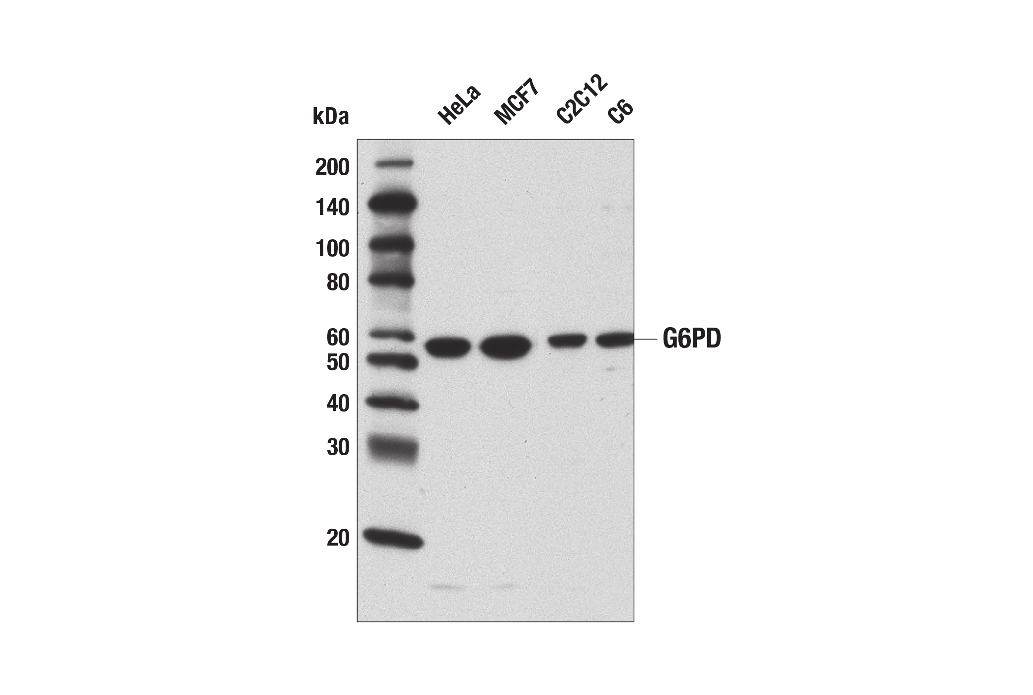 Western Blotting Image 1: G6PD Antibody