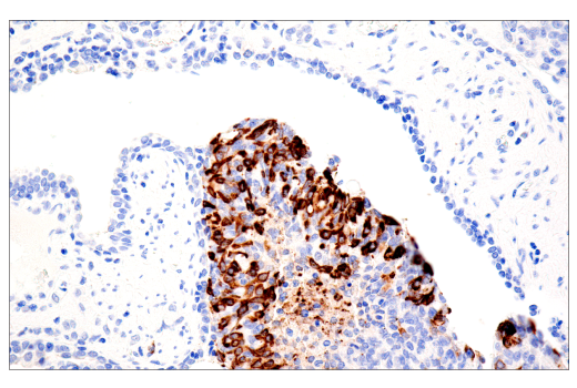 Immunohistochemistry Image 6: MUC2 (CCP58) Mouse mAb