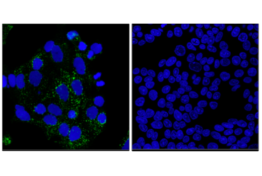 Immunofluorescence Image 1: LAMP3/CD208 (E6E5U) XP® Rabbit mAb (BSA and Azide Free)