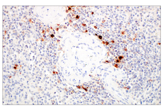 Immunohistochemistry Image 8: LAMP3/CD208 (E6E5U) XP® Rabbit mAb (BSA and Azide Free)