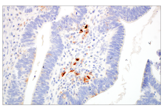 Immunohistochemistry Image 2: LAMP3/CD208 (E6E5U) XP® Rabbit mAb (BSA and Azide Free)