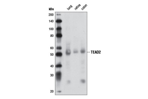 Western Blotting Image 2: TEAD2 Antibody