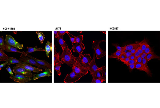 Immunofluorescence Image 1: PDGF Receptor α (D13C6) XP® Rabbit mAb (Alexa Fluor® 488 Conjugate)