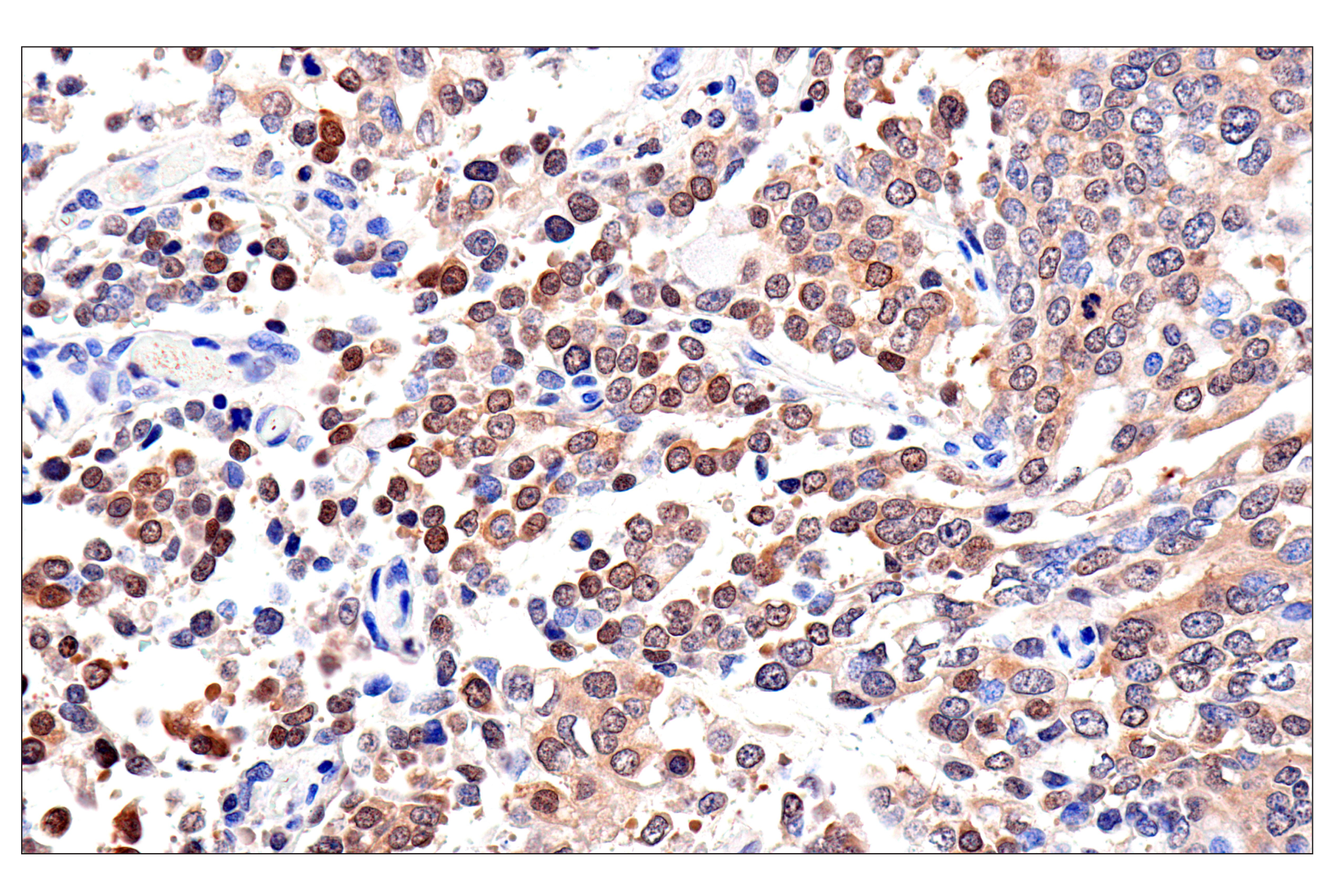 Immunohistochemistry Image 1: Caspase-8 (F5K9P) Rabbit mAb
