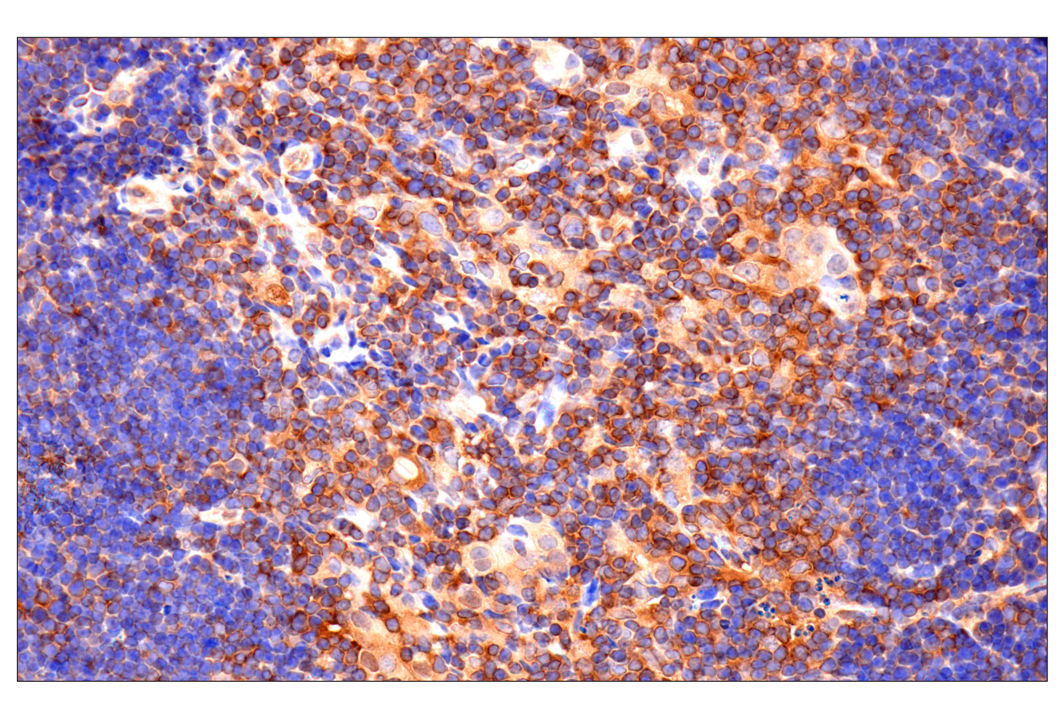 Immunohistochemistry Image 8: Caspase-8 (F5K9P) Rabbit mAb