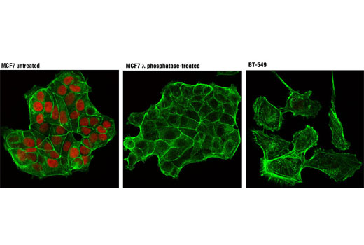 Immunofluorescence Image 1: Phospho-Rb (Ser807/811) (D20B12) XP® Rabbit mAb (Alexa Fluor® 594 Conjugate)