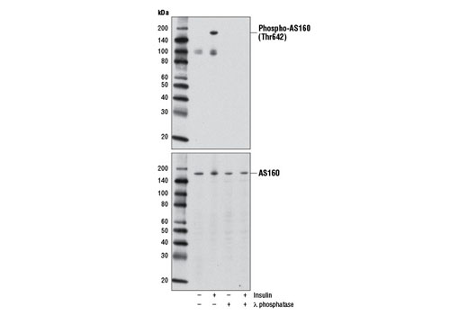  Image 8: AS160 Signaling Antibody Sampler Kit