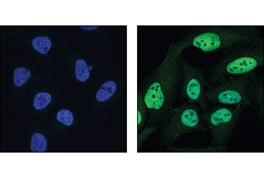Immunofluorescence Image 1: Phospho-Stat1 (Tyr701) (58D6) Rabbit mAb (BSA and Azide Free)