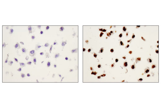 Immunohistochemistry Image 4: Phospho-Stat1 (Tyr701) (58D6) Rabbit mAb (BSA and Azide Free)