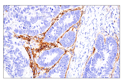 Immunohistochemistry Image 2: NCAM1 (CD56) (E7X9M) XP® Rabbit mAb (BSA and Azide Free)