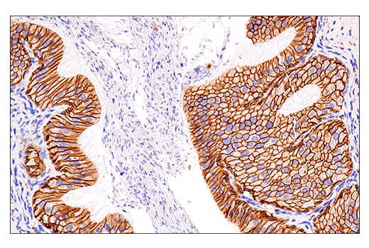 Immunohistochemistry Image 6: NCAM1 (CD56) (E7X9M) XP® Rabbit mAb (BSA and Azide Free)