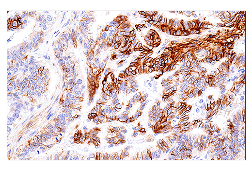Immunohistochemistry Image 5: NCAM1 (CD56) (E7X9M) XP® Rabbit mAb (BSA and Azide Free)