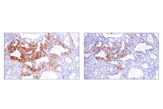 Immunohistochemistry Image 11: NCAM1 (CD56) (E7X9M) XP® Rabbit mAb (BSA and Azide Free)