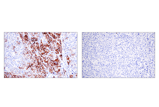 Immunohistochemistry Image 10: NCAM1 (CD56) (E7X9M) XP® Rabbit mAb (BSA and Azide Free)
