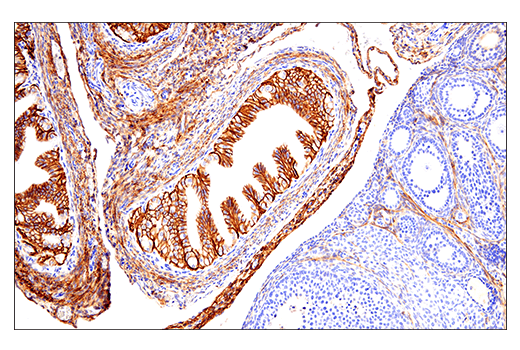 Immunohistochemistry Image 8: NCAM1 (CD56) (E7X9M) XP® Rabbit mAb (BSA and Azide Free)