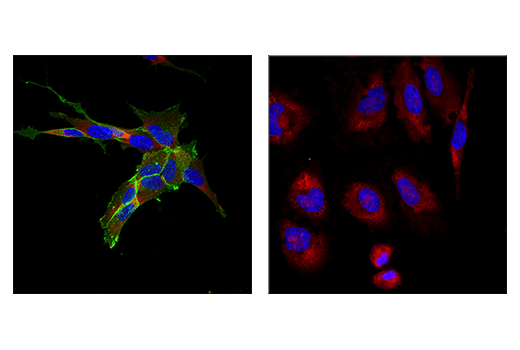 Immunofluorescence Image 2: NCAM1 (CD56) (E7X9M) XP® Rabbit mAb (BSA and Azide Free)