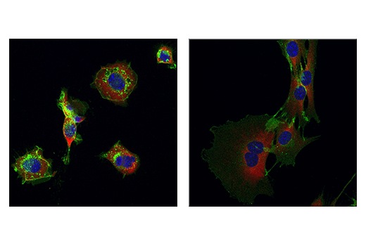 Immunofluorescence Image 3: NCAM1 (CD56) (E7X9M) XP® Rabbit mAb (BSA and Azide Free)