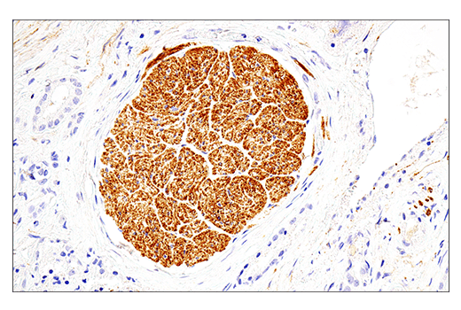 Immunohistochemistry Image 1: NCAM1 (CD56) (E7X9M) XP® Rabbit mAb (BSA and Azide Free)