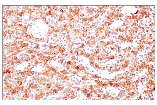 Immunohistochemistry Image 7: NCAM1 (CD56) (E7X9M) XP® Rabbit mAb (BSA and Azide Free)