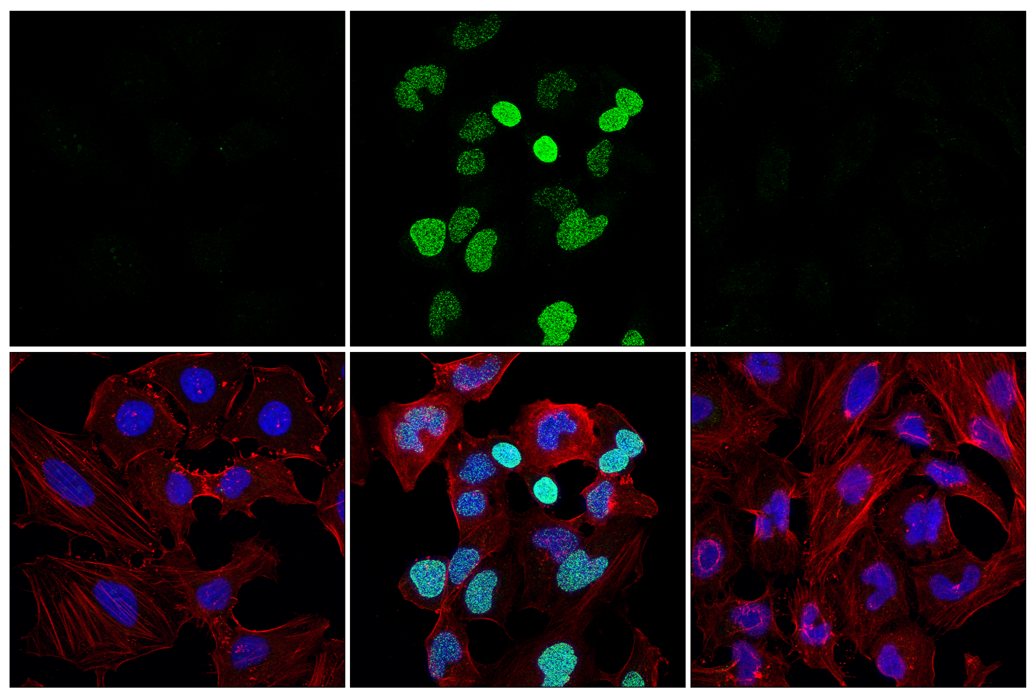 Immunofluorescence Image 1: Poly/Mono-ADP Ribose (D9P7Z) Rabbit mAb (Alexa Fluor® 488 Conjugate)