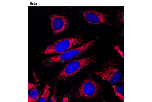 Immunofluorescence Image 1: Anti-rabbit IgG (H+L), F(ab')2 Fragment (Alexa Fluor® 594 Conjugate)