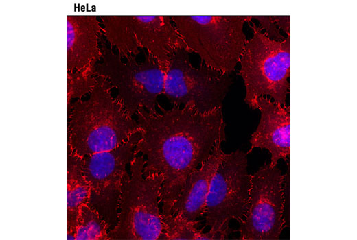 Immunofluorescence Image 2: Anti-mouse IgG (H+L), F(ab')2 Fragment (Alexa Fluor® 594 Conjugate)